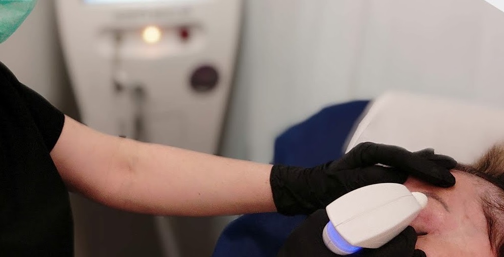 blefaroplastie cu laser